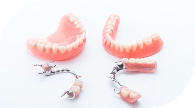 Prothèse dentaire partielle : ce qu'il faut savoir