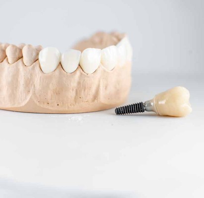 Docteur Serge Métier à Bapaume